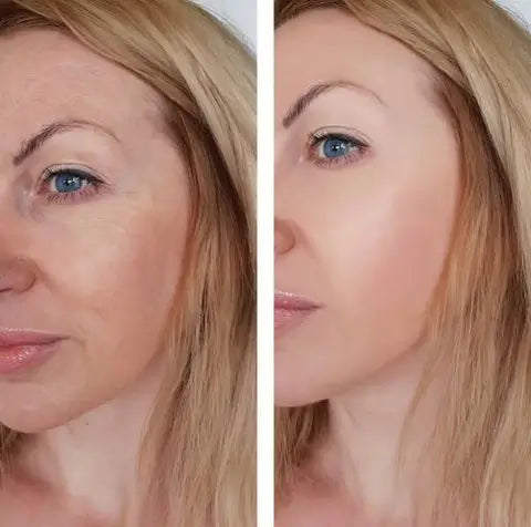 Crème magique FaceSlift® - dissimule 100% des imperfections et élimine les taches et les rides
